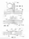 Fig. 08 - Surgical retractor with gel pad