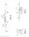 Fig. 04 - Implantable medical sensor and fixation system