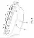 Fig. 05 - Implantable medical sensor and fixation system