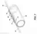 Fig. 06 - Implantable medical sensor and fixation system