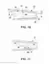 Fig. 10 - Implantable medical sensor and fixation system