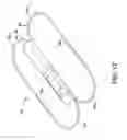 Fig. 14 - Implantable medical sensor and fixation system