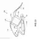 Fig. 16 - Implantable medical sensor and fixation system
