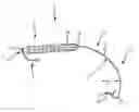 Fig. 01 - Steerable sheath access device
