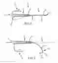 Fig. 06 - Steerable sheath access device