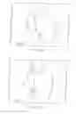 Fig. 09 - Apparatus and method for cardiac ablation