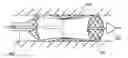 Fig. 01 - Methods and devices for eluting agents to a vessel