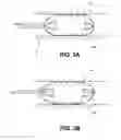 Fig. 05 - Methods and devices for eluting agents to a vessel