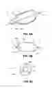 Fig. 10 - Methods and devices for eluting agents to a vessel