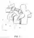 Fig. 02 - Tissue insertion type ultrasonic probe