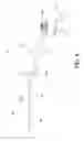 Fig. 05 - Tissue insertion type ultrasonic probe
