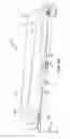 Fig. 06 - CATHETER WITH SHAPE MEMORY ALLOY ACTUATOR