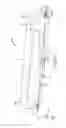 Fig. 07 - CATHETER WITH SHAPE MEMORY ALLOY ACTUATOR