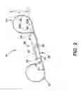 Fig. 03 - Implantable medical sensor and fixation system