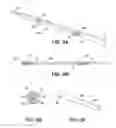 Fig. 08 - Implantable medical sensor and fixation system
