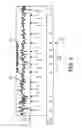 Fig. 07 - Method and apparatus for reducing noise in a medical device