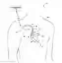 Fig. 01 - Ischemia detection and classification