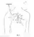 Fig. 02 - Ischemia detection and classification