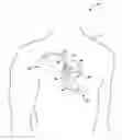 Fig. 01 - MORPHOLOGY CHANGE DETECTION FOR CARDIAC SIGNAL ANALYSIS