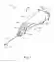 Fig. 02 - Handheld biopsy device with needle firing