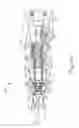 Fig. 20 - Handheld biopsy device with needle firing