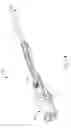 Fig. 24 - Handheld biopsy device with needle firing