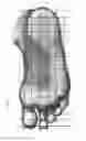 Fig. 06 - Peripheral sensory and supersensory replacement system