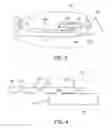 Fig. 04 - Cervical sizing devices and related kits and methods