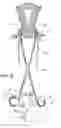 Fig. 08 - Cervical sizing devices and related kits and methods