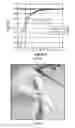 Fig. 49 - SYSTEMS AND METHODS TO TARGET BLOOD VESSEL ADVENTITIA WITH TRANSCUTANEOUS FOCUSED ULTRASOUND