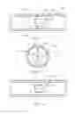 Fig. 04 - Osmotic devices and methods for diuretic therapy