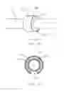 Fig. 08 - Osmotic devices and methods for diuretic therapy