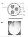 Fig. 01 - Encapsulation of microbubbles within the aqueous core of microcapsules