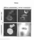 Fig. 07 - Encapsulation of microbubbles within the aqueous core of microcapsules