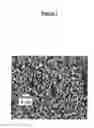 Fig. 08 - Encapsulation of microbubbles within the aqueous core of microcapsules