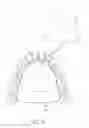 Fig. 15 - DEVICES, METHODS, AND KITS FOR TASTE MODIFICATION AND CONTROLLING FOOD INTAKE