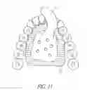 Fig. 16 - DEVICES, METHODS, AND KITS FOR TASTE MODIFICATION AND CONTROLLING FOOD INTAKE