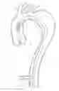 Fig. 01 - Introducer Assembly and Dilator Tip Therefor