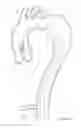 Fig. 07 - Introducer Assembly and Dilator Tip Therefor