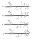 Fig. 03 - APPARATUS AND METHODS FOR TREATING OBSTRUCTIONS WITHIN BODY LUMENS