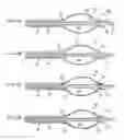 Fig. 04 - APPARATUS AND METHODS FOR TREATING OBSTRUCTIONS WITHIN BODY LUMENS