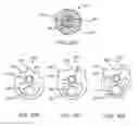 Fig. 09 - APPARATUS AND METHODS FOR TREATING OBSTRUCTIONS WITHIN BODY LUMENS