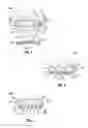 Fig. 02 - Transdermal fluid delivery device