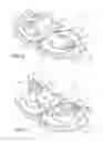 Fig. 02 - Catheter securement device with slit between first and second pull tabs