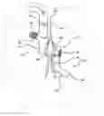 Fig. 01 - CATHETER SECUREMENT DEVICE TO SECURE SILICONE WINGED PICCS