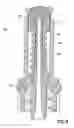 Fig. 09 - Swabbable Needle-Free Injection Port Valve System With Zero Fluid Displacement