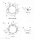 Fig. 02 - Swaged braided catheter and method of fabrication