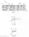 Fig. 04 - Swaged braided catheter and method of fabrication