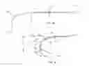 Fig. 04 - Telescoping catheter delivery system for left heart endocardial device placement