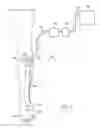 Fig. 02 - Limited-access, reduced-pressure systems and methods
